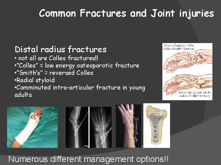 Common Fractures and Joint injuries Distal radius fractures • not all are Colles fractures!!