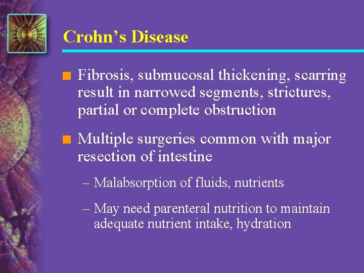 Crohn’s Disease n Fibrosis, submucosal thickening, scarring result in narrowed segments, strictures, partial or