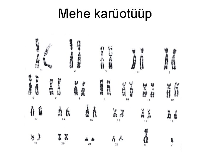 Mehe karüotüüp 