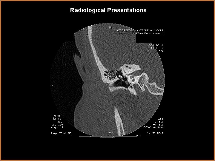 Radiological Presentations 