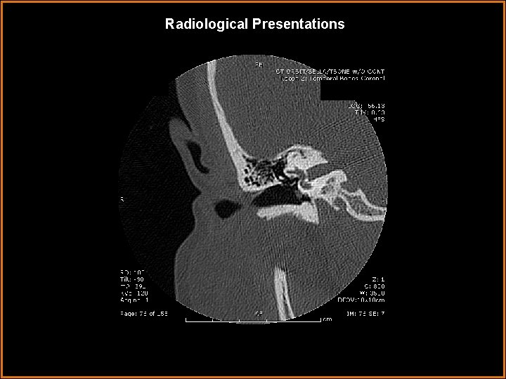 Radiological Presentations 