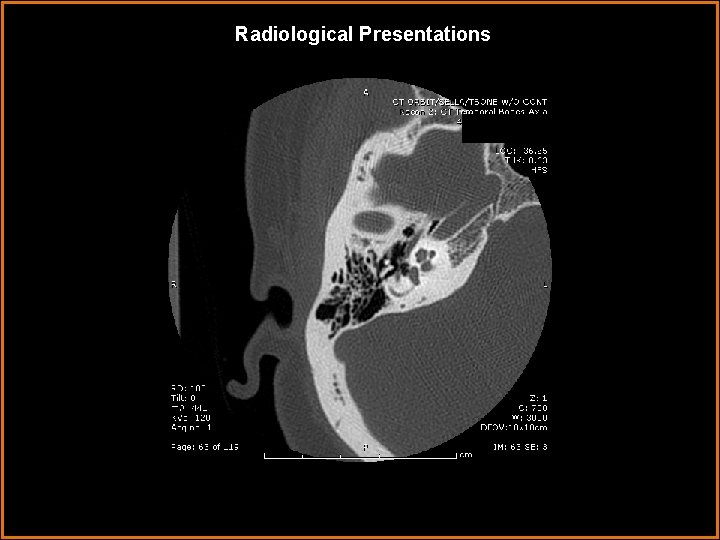 Radiological Presentations 