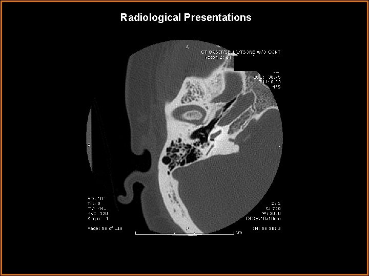 Radiological Presentations 
