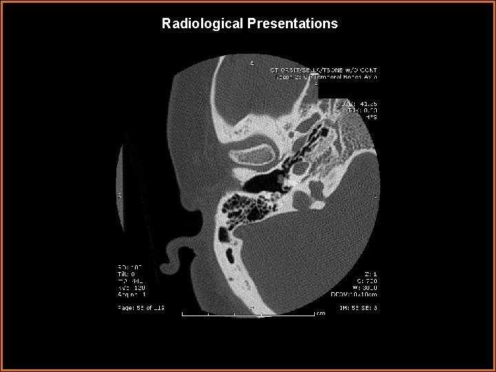 Radiological Presentations 