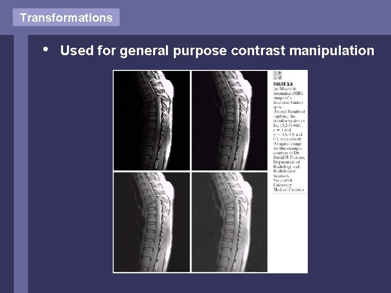 Transformations • Used for general purpose contrast manipulation Transformations • Used for general purpose contrast manipulation