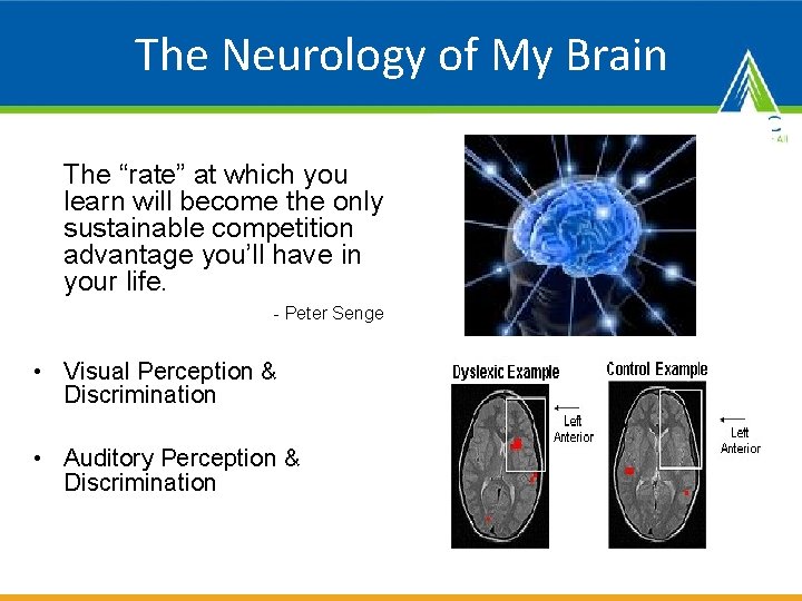 The Neurology of My Brain The “rate” at which you learn will become the
