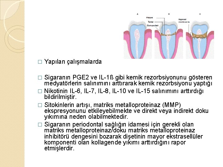 � Yapılan çalışmalarda Sigaranın PGE 2 ve IL-1ß gibi kemik rezorbsiyonunu gösteren medyatörlerin salınımını