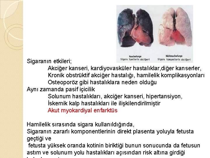 Sigaranın etkileri; Akciğer kanseri, kardiyovasküler hastalıklar, diğer kanserler, Kronik obstrüktif akciğer hastalığı, hamilelik komplikasyonları