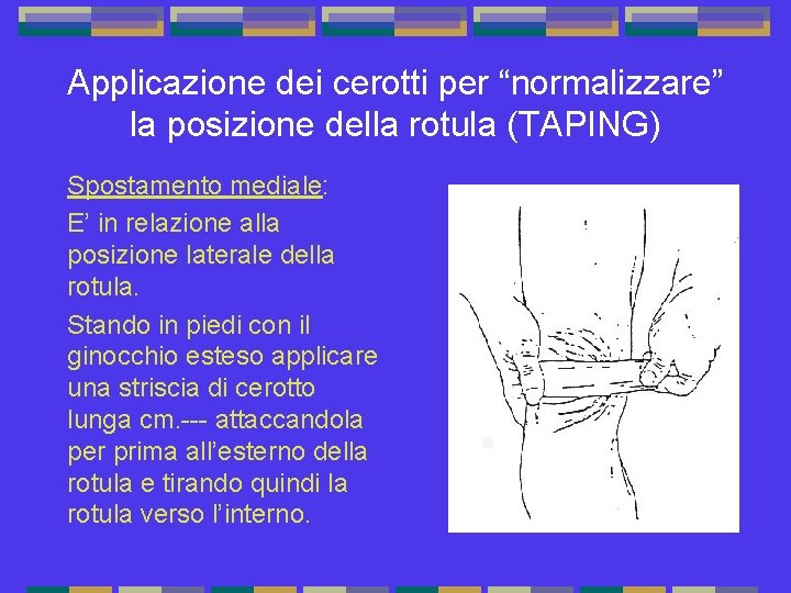 Applicazione dei cerotti per “normalizzare” la posizione della rotula (TAPING) Spostamento mediale: E’ in