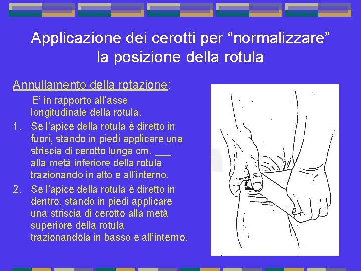 Applicazione dei cerotti per “normalizzare” la posizione della rotula Annullamento della rotazione: E’ in