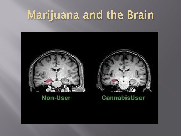 Marijuana and the Brain 