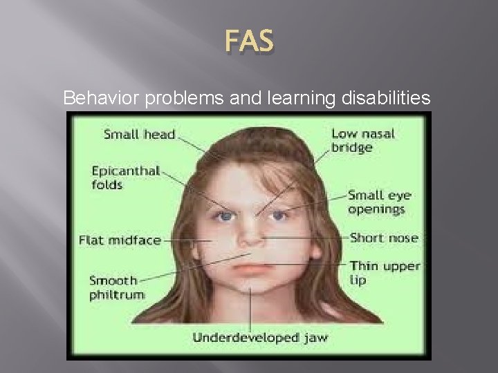 FAS Behavior problems and learning disabilities 