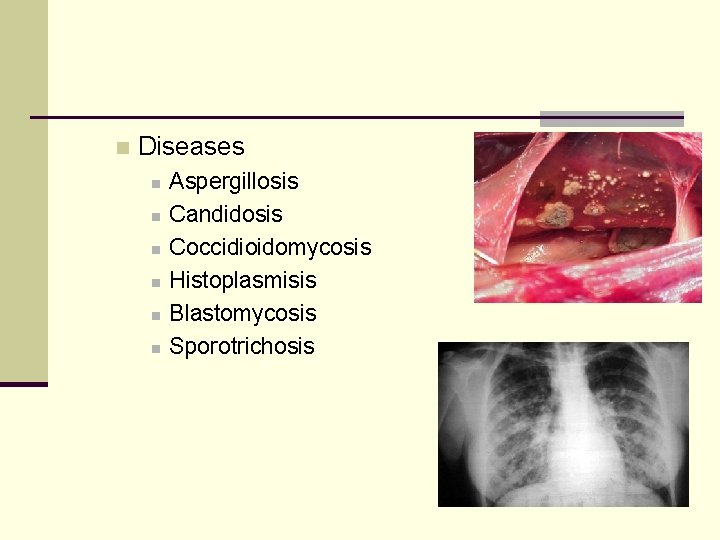 n Diseases n n n Aspergillosis Candidosis Coccidioidomycosis Histoplasmisis Blastomycosis Sporotrichosis 