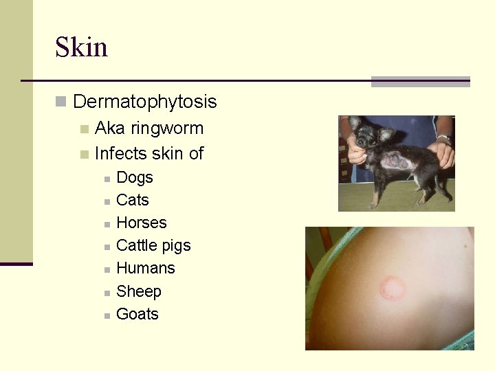 Skin n Dermatophytosis n Aka ringworm n Infects skin of n n n n