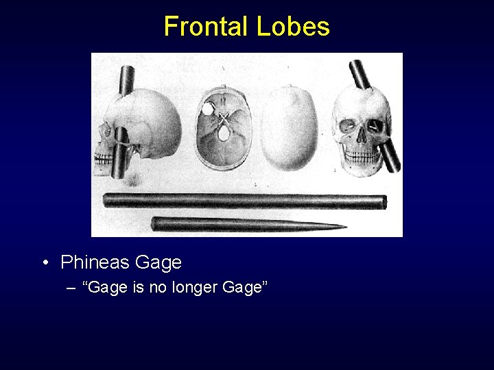 Frontal Lobes • Phineas Gage – “Gage is no longer Gage” Frontal Lobes • Phineas Gage – “Gage is no longer Gage”