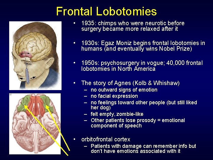 Frontal Lobotomies • 1935: chimps who were neurotic before surgery became more relaxed after Frontal Lobotomies • 1935: chimps who were neurotic before surgery became more relaxed after