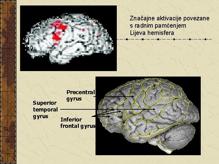 Značajne aktivacije povezane s radnim pamćenjem Lijeva hemisfera Superior temporal gyrus Precentral gyrus Inferior
