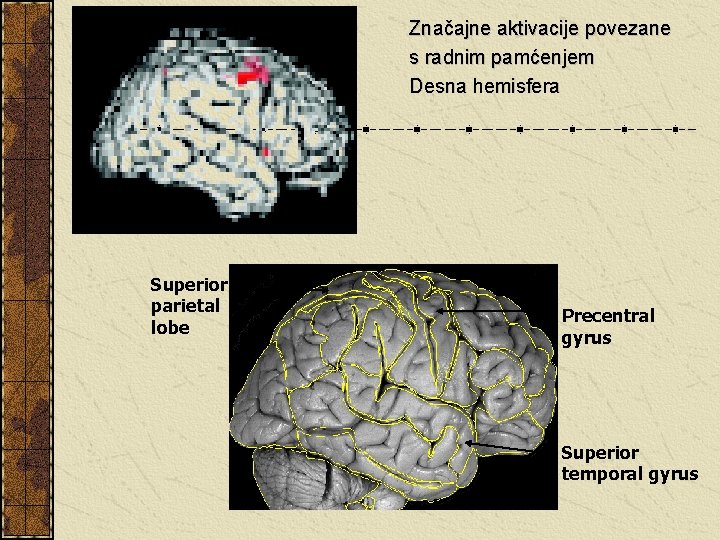 Značajne aktivacije povezane s radnim pamćenjem Desna hemisfera Superior parietal lobe Precentral gyrus Superior