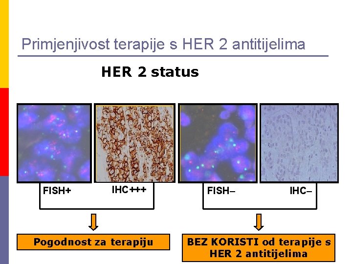 Primjenjivost terapije s HER 2 antitijelima HER 2 status FISH+ IHC+++ Pogodnost za terapiju