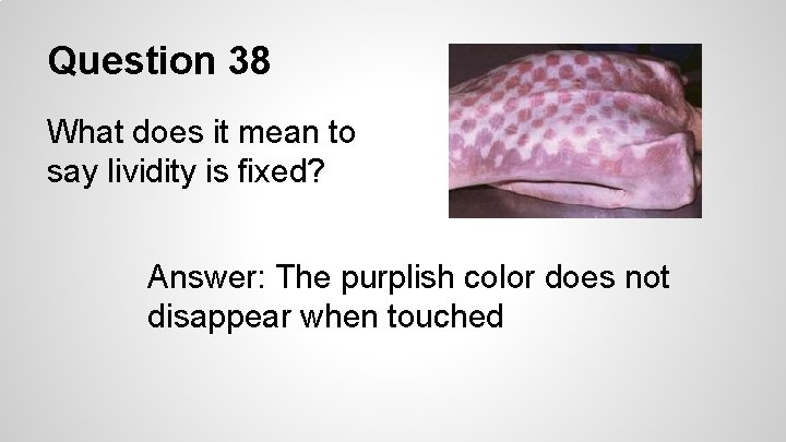 Question 38 What does it mean to say lividity is fixed? Answer: The purplish
