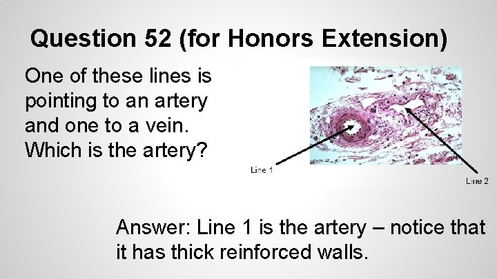Question 52 (for Honors Extension) One of these lines is pointing to an artery
