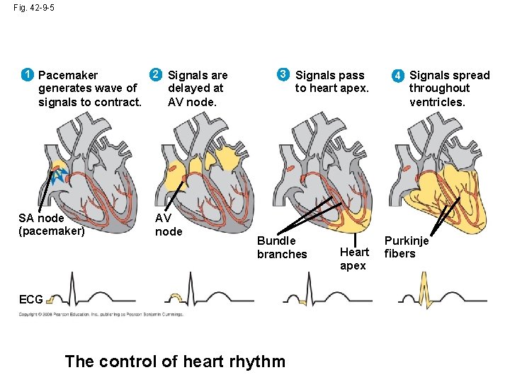 Fig. 42 -9 -5 1 Pacemaker generates wave of signals to contract. SA node