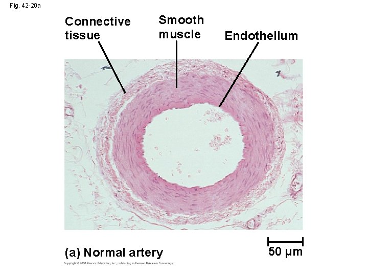 Fig. 42 -20 a Connective tissue Smooth muscle (a) Normal artery Endothelium 50 µm