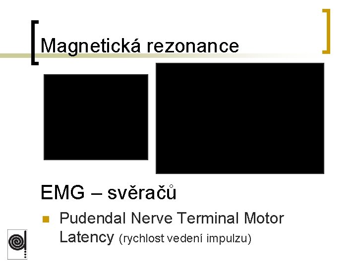 Magnetická rezonance EMG – svěračů n Pudendal Nerve Terminal Motor Latency (rychlost vedení impulzu)