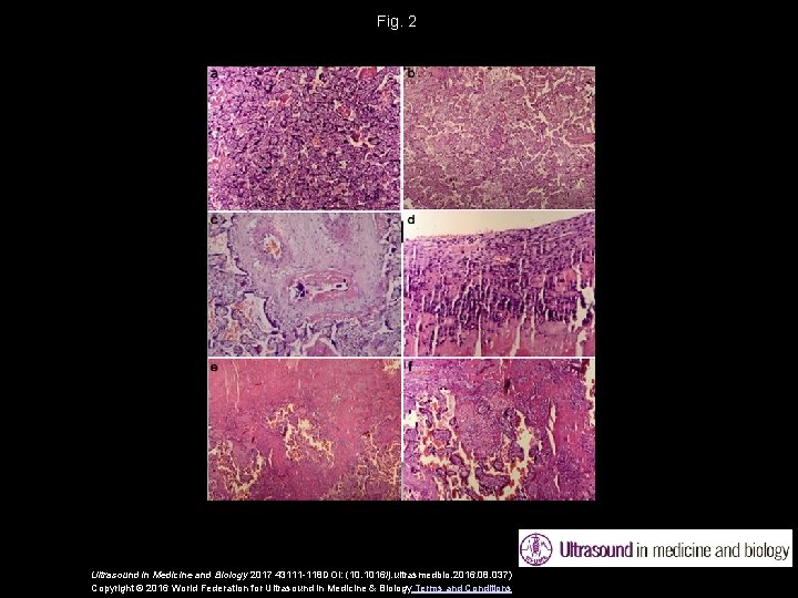 Fig. 2 Ultrasound in Medicine and Biology 2017 43111 -118 DOI: (10. 1016/j. ultrasmedbio.