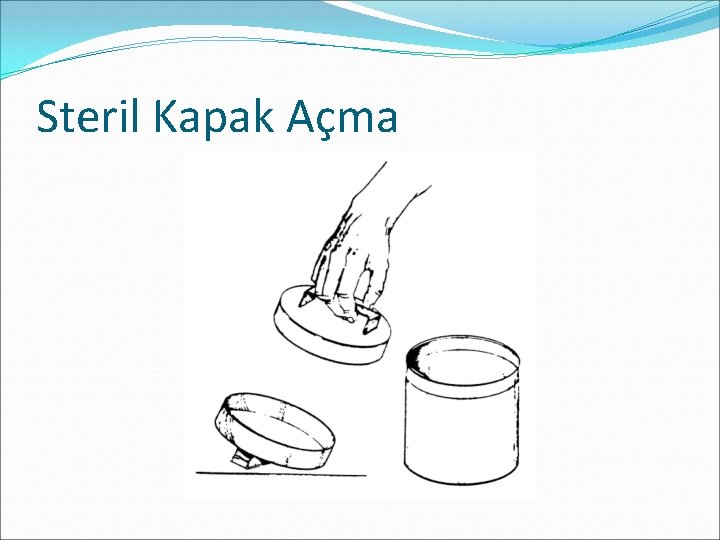 Steril Kapak Açma Steril Kapak Açma