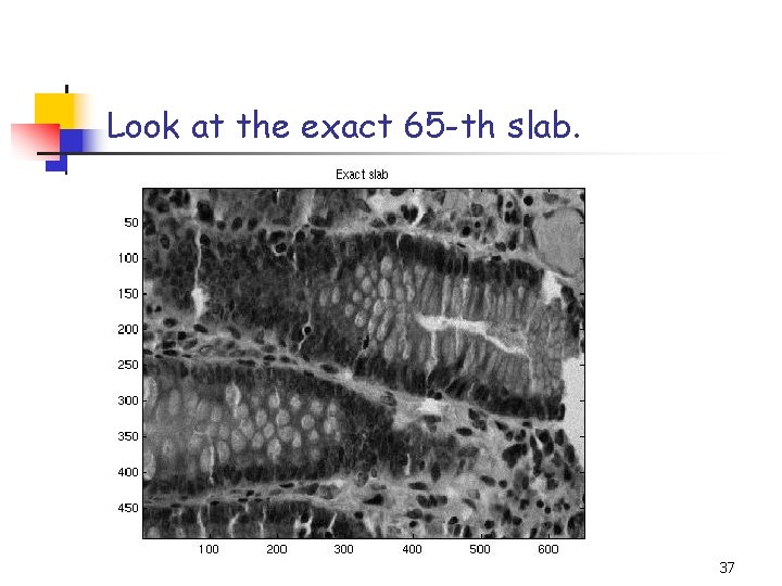 Look at the exact 65 -th slab. 37 