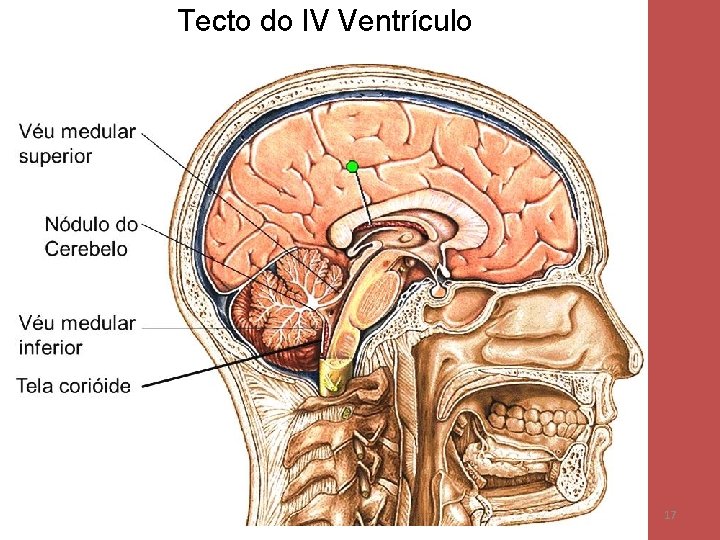 Tecto do IV Ventrículo 17 