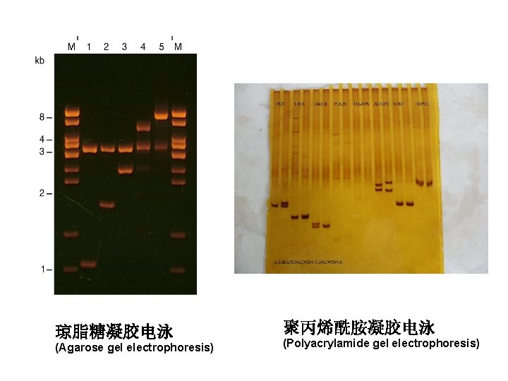 琼脂糖凝胶电泳 (Agarose gel electrophoresis) 聚丙烯酰胺凝胶电泳 (Polyacrylamide gel electrophoresis) 