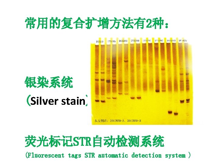 常用的复合扩增方法有2种： 银染系统 (Silver stain) 荧光标记STR自动检测系统 (Fluorescent tags STR automatic detection system ) 