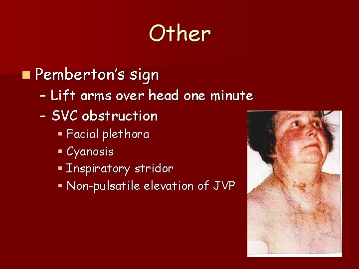 Respiratory Examination Dr Scarpa Schoeman Dept Internal Medicine Respiratory Examination Dr Scarpa Schoeman Dept Internal Medicine