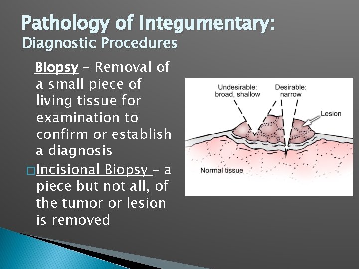 Pathology of Integumentary: Diagnostic Procedures Biopsy – Removal of a small piece of living