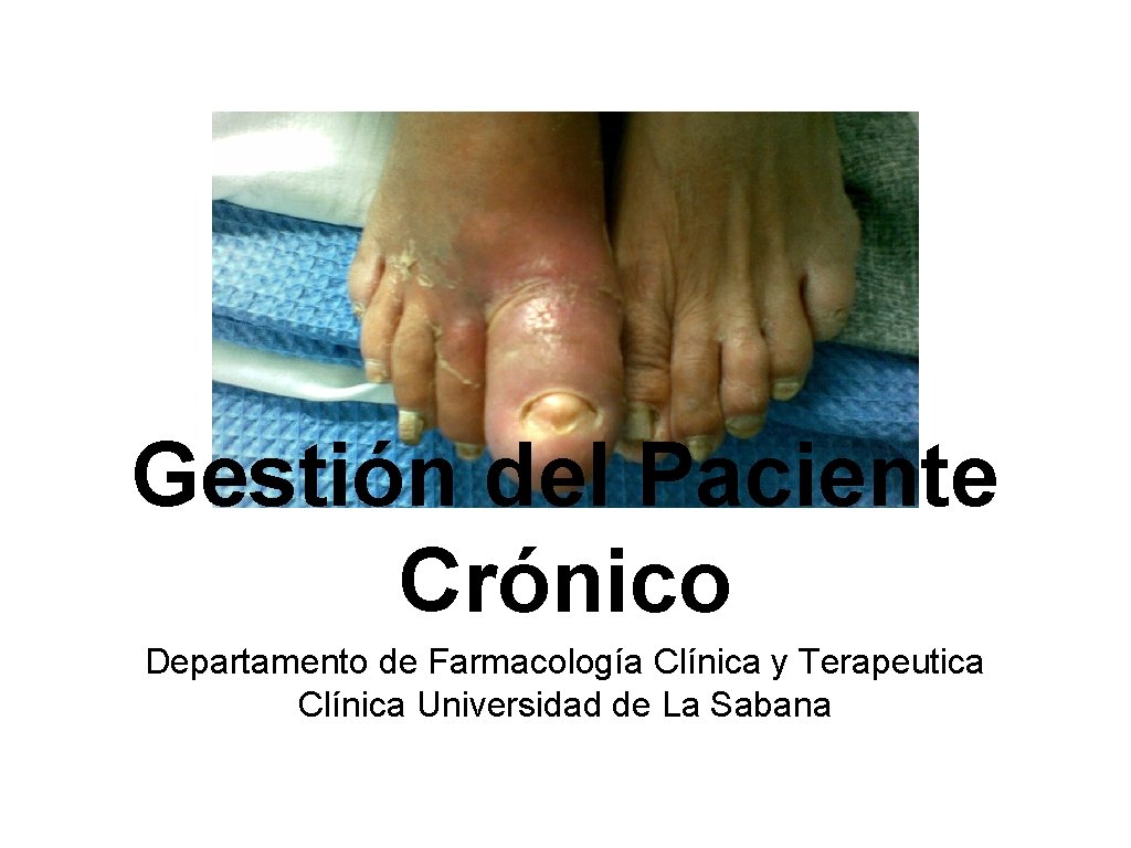 Gestión del Paciente Crónico Departamento de Farmacología Clínica y Terapeutica Clínica Universidad de La