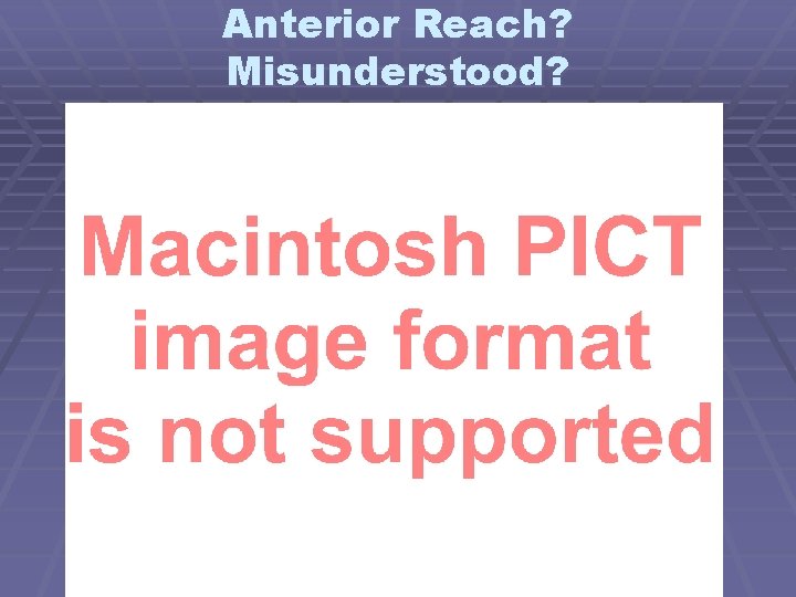 Anterior Reach? Misunderstood? 