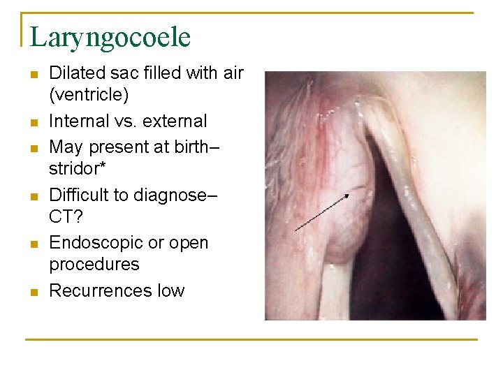 Laryngocoele n n n Dilated sac filled with air (ventricle) Internal vs. external May