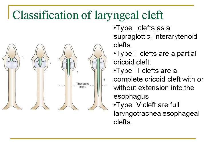 Classification of laryngeal cleft • Type I clefts as a supraglottic, interarytenoid clefts. •