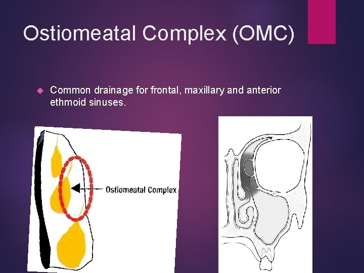 Ostiomeatal Complex (OMC) Common drainage for frontal, maxillary and anterior ethmoid sinuses. 