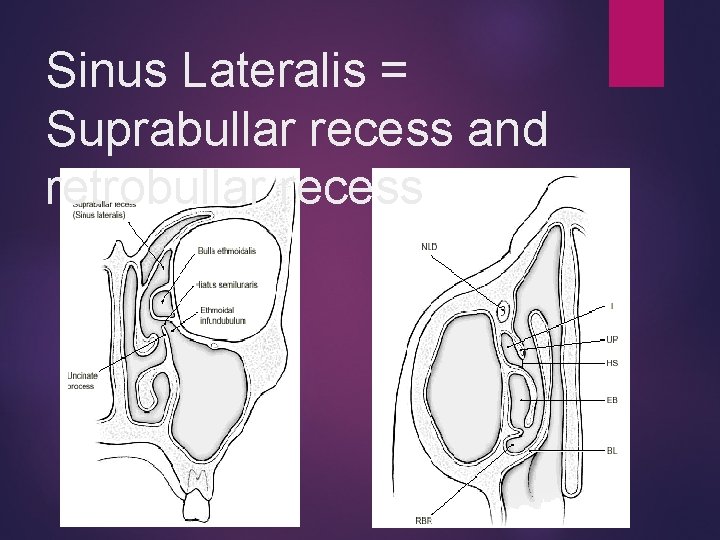 Sinus Lateralis = Suprabullar recess and retrobullar recess 