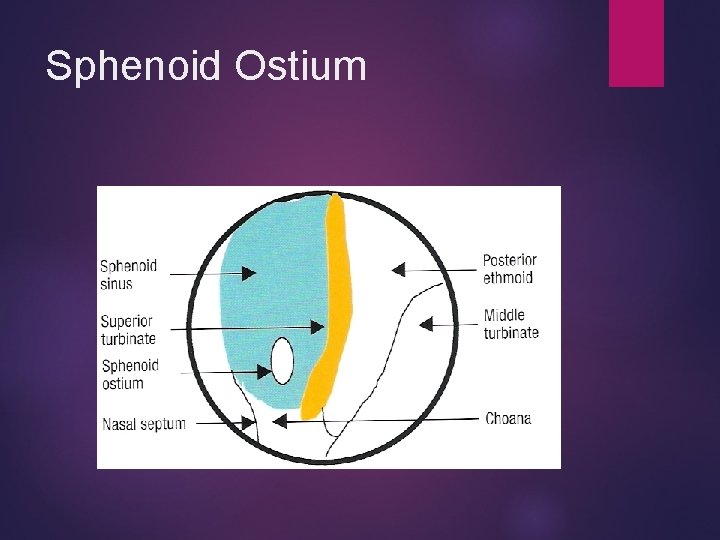Sphenoid Ostium 