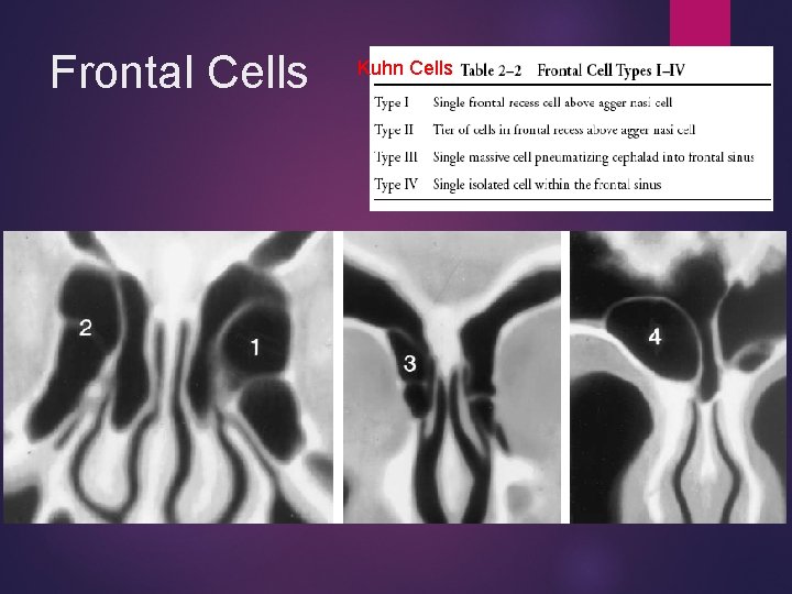 Frontal Cells Kuhn Cells 