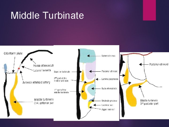 Middle Turbinate 