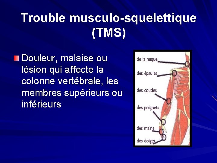 Trouble musculo-squelettique (TMS) Douleur, malaise ou lésion qui affecte la colonne vertébrale, les membres