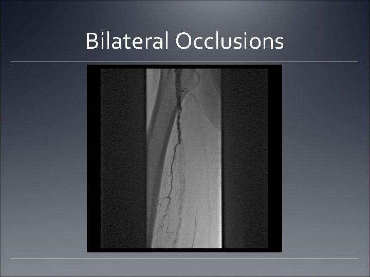 Bilateral Occlusions Bilateral Occlusions