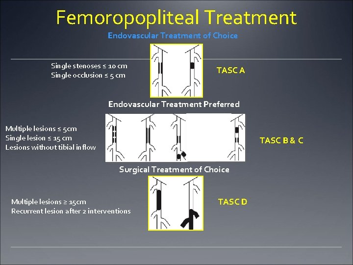 Femoropopliteal Treatment Endovascular Treatment of Choice Single stenoses ≤ 10 cm Single occlusion ≤ Femoropopliteal Treatment Endovascular Treatment of Choice Single stenoses ≤ 10 cm Single occlusion ≤