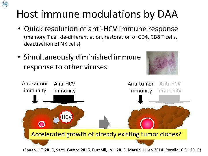 Host immune modulations by DAA • Quick resolution of anti-HCV immune response (memory T
