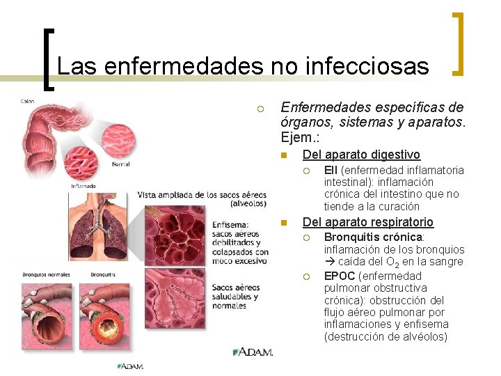 Las enfermedades no infecciosas ¡ Enfermedades específicas de órganos, sistemas y aparatos. Ejem. :